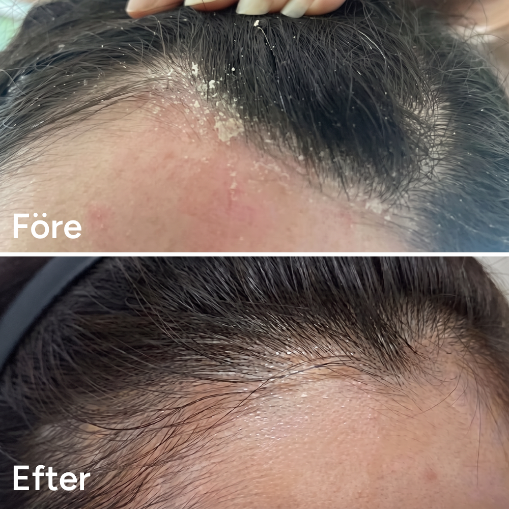 Anti-Flake Serum