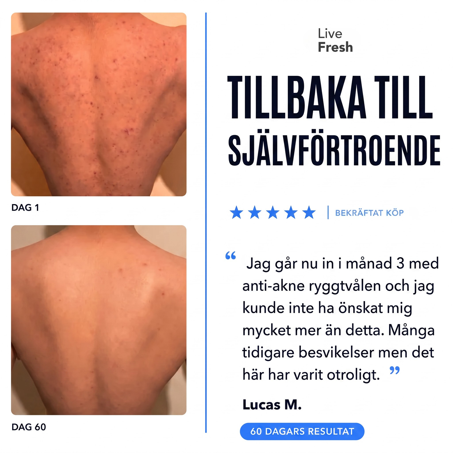 Anti-Akne Ryggtvål