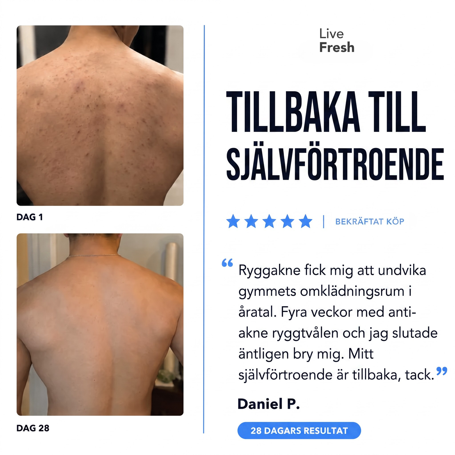 Anti-Akne Ryggtvål