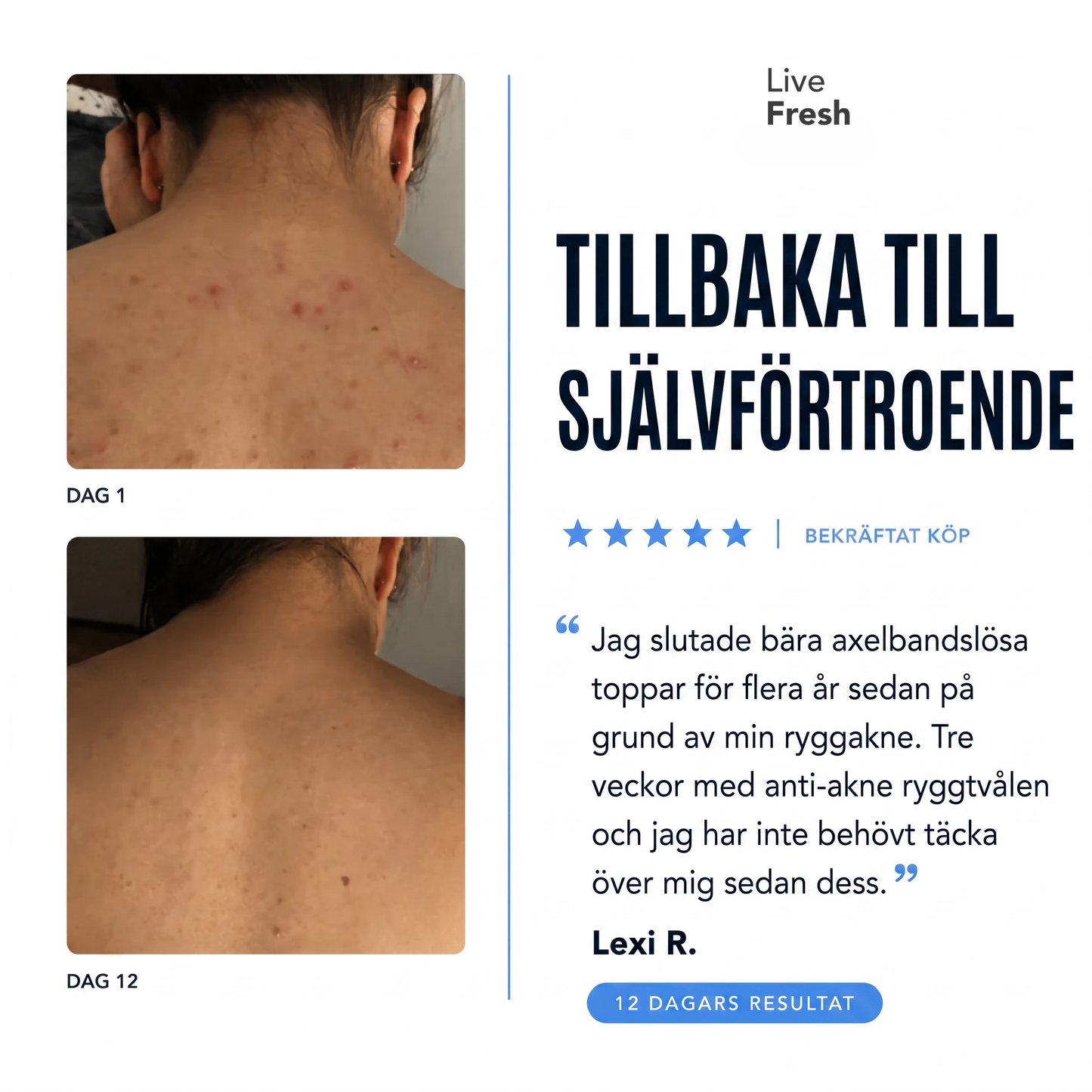 Anti-Akne Ryggtvål