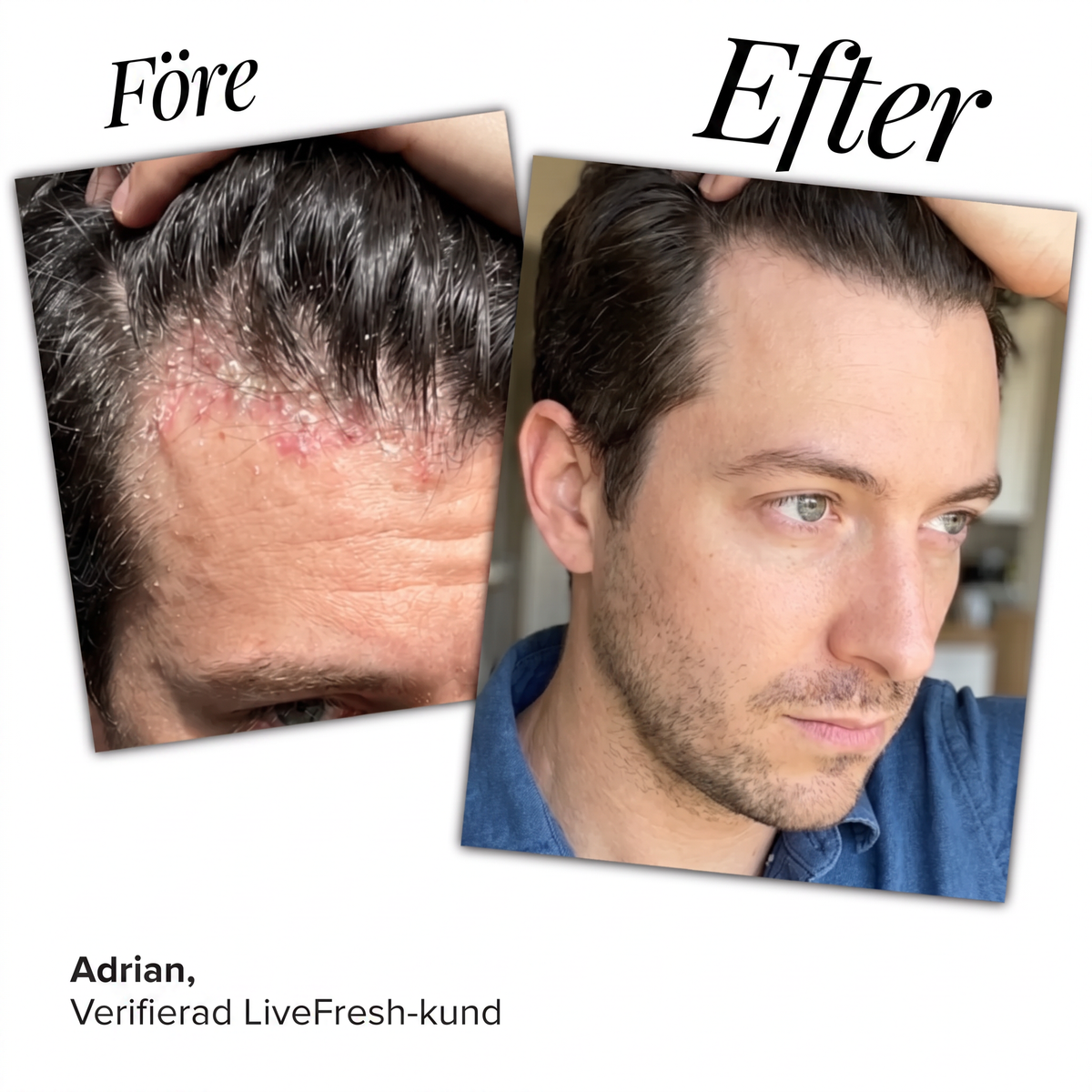 Anti-Flake Serum