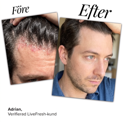 Anti-Flake Serum