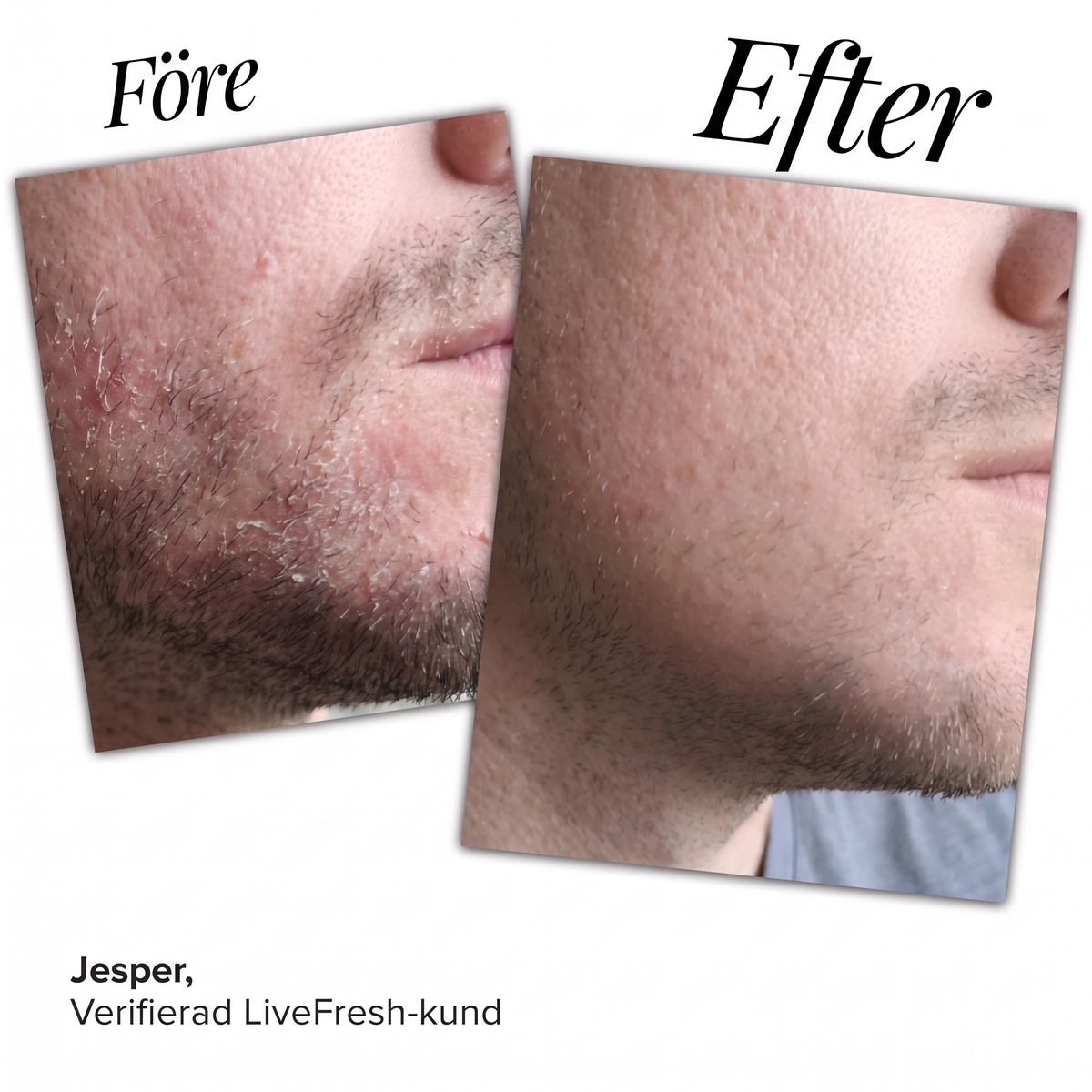 Anti-Flake Serum