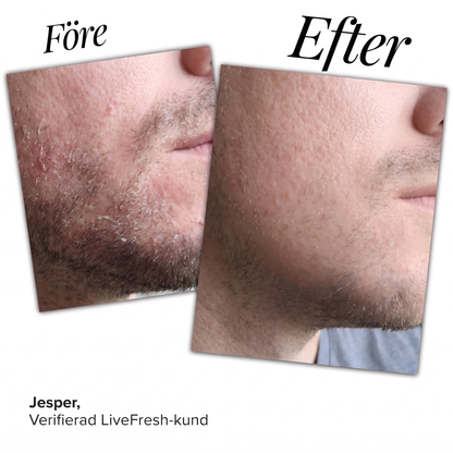 Anti-Flake Serum