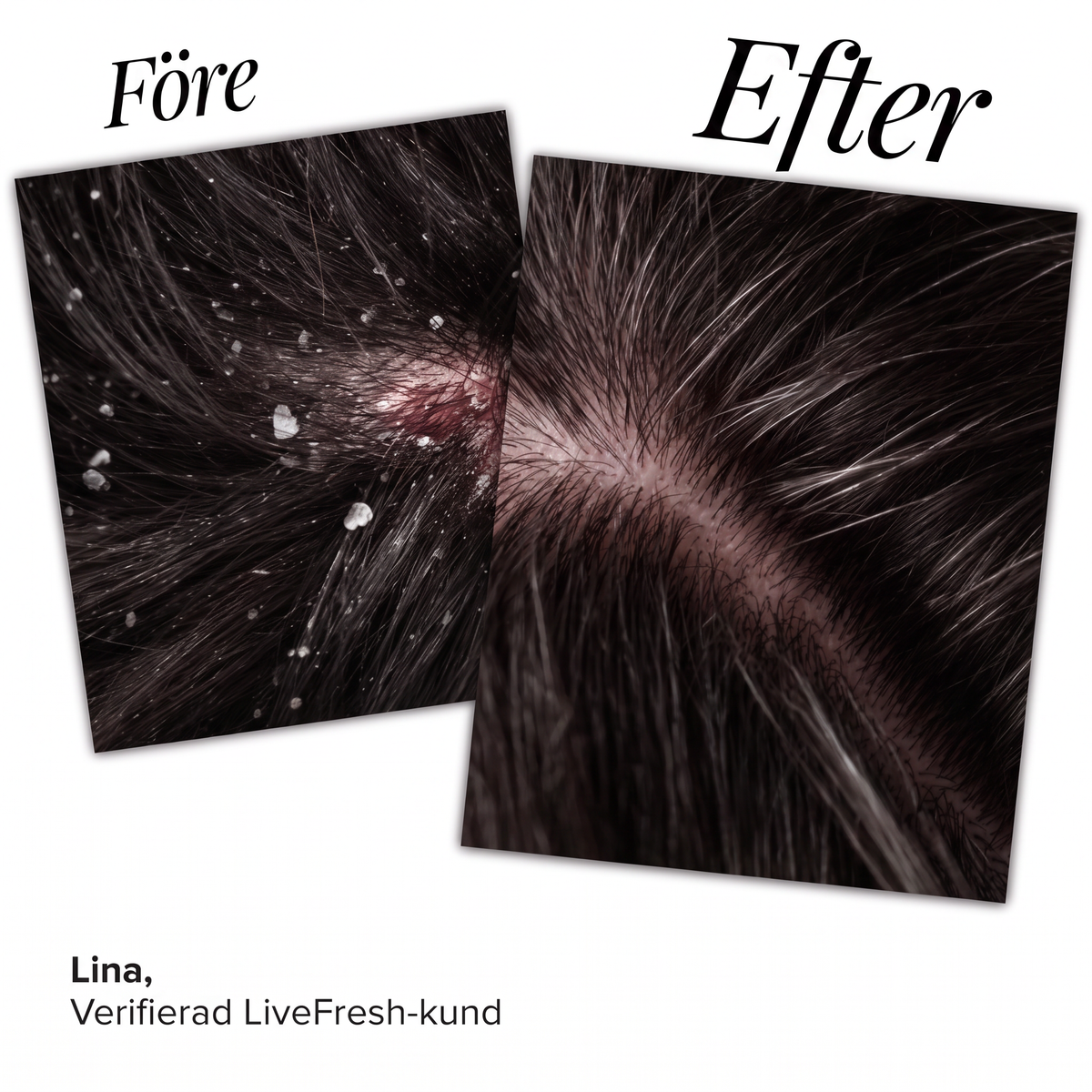Anti-Flake Serum